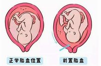 2026黑龙江省试管婴儿费用明细？附试管婴儿补贴政策？