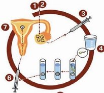 降调一直降不下去能做试管吗？