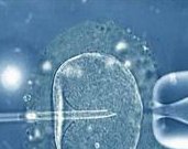 长沙做二代试管婴儿失败的原因有哪些？受那些因素的影响？